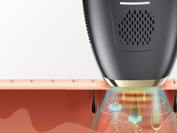 How does laser hair removal work?