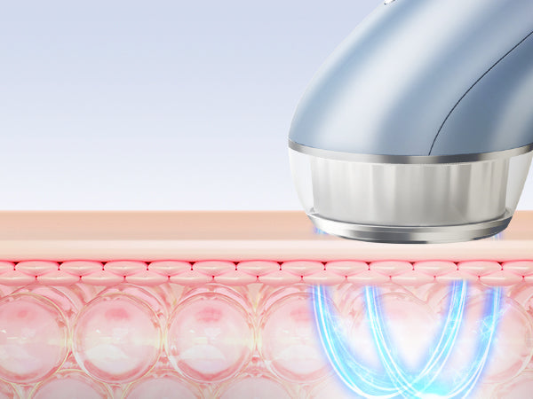 Nine benefits of RF Radio Frequency  devices