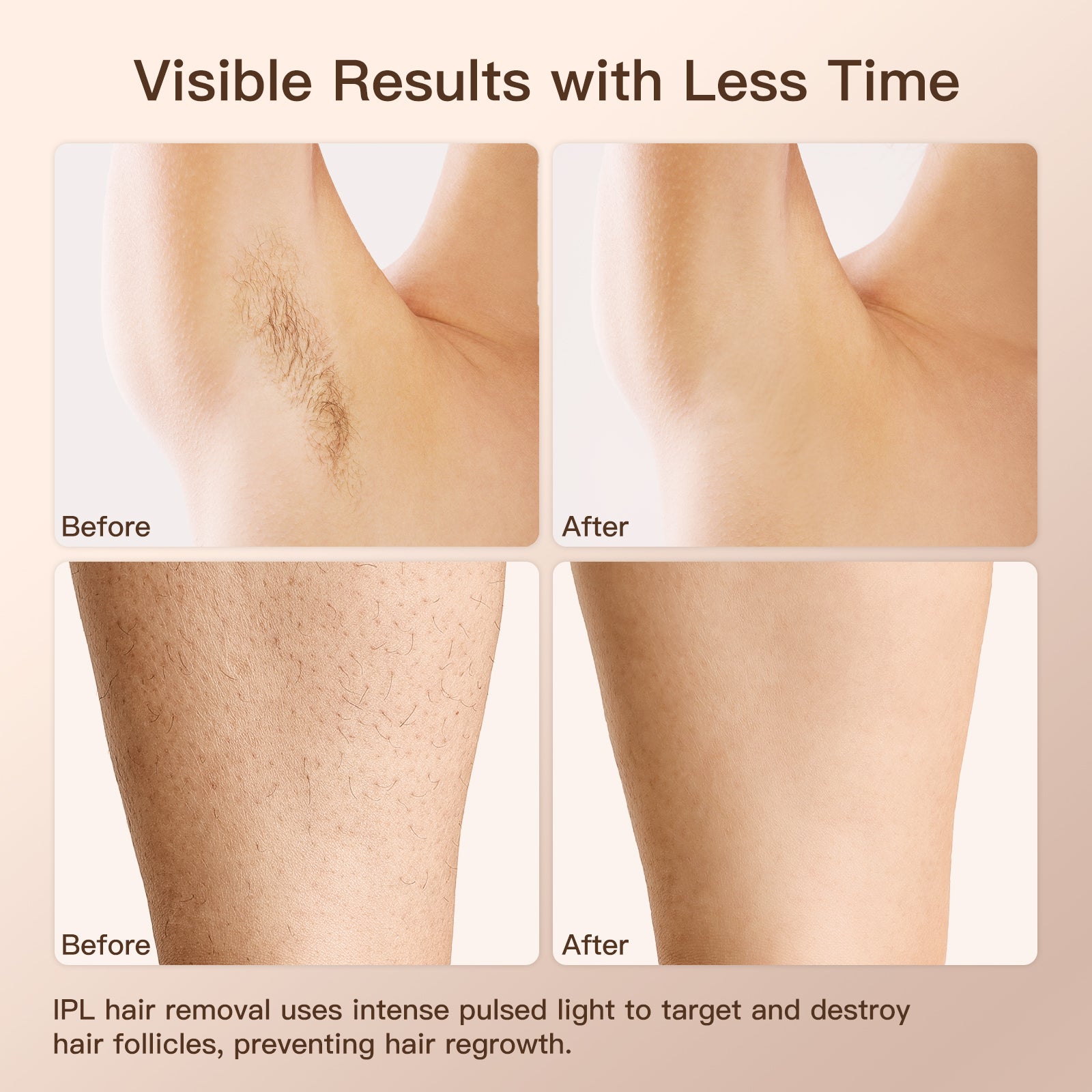 Mini IPL Hair Removal T4