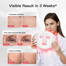 Iborria M226-A LED Light Therapy Mask
