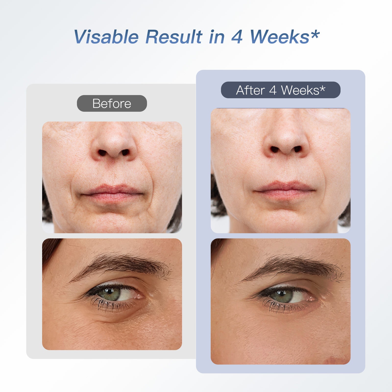 IBORRIA Aura2 Pro RF Anti-aging Beauty Device